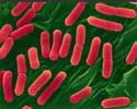 http://www.fib.is/myndir/E.coli-bakteriur.jpg